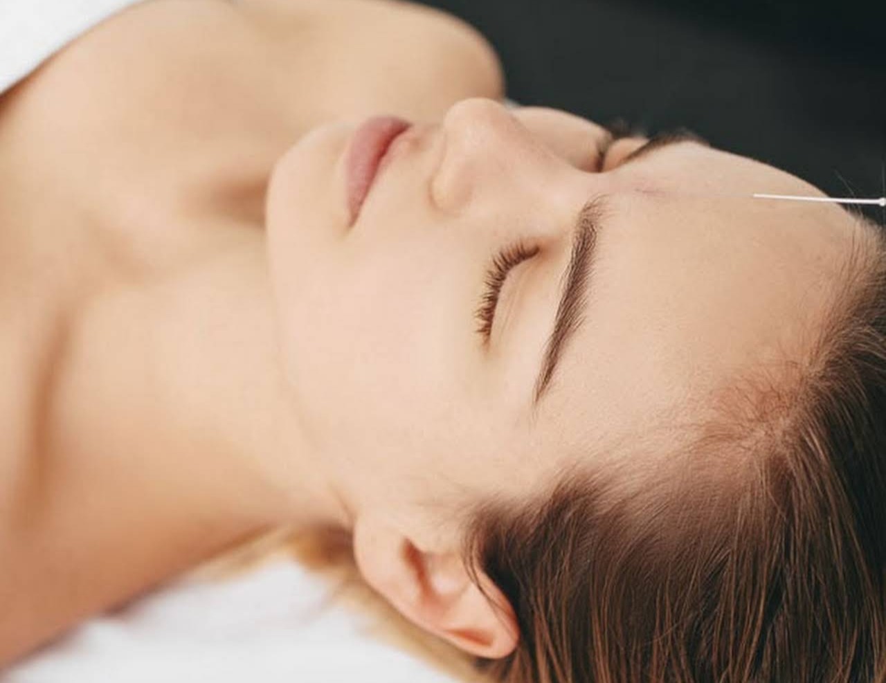 Acupuncture for Relaxation acupuncture for Stress and Anxiety