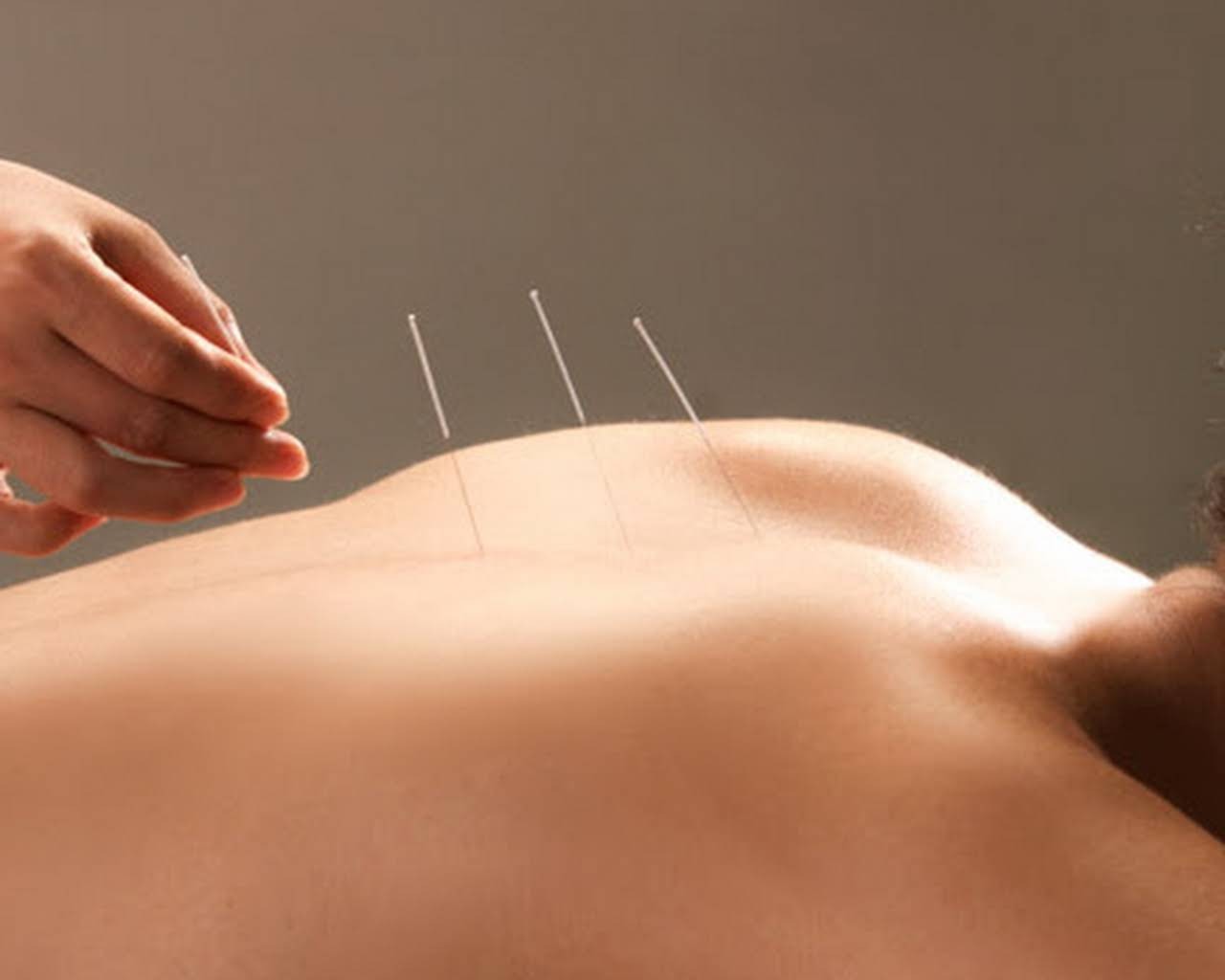 Acupuncture Tune-up Treating Anxiety, Depression and Sleep